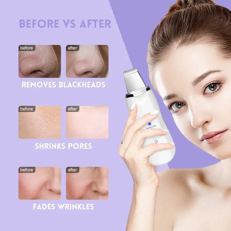 Skin Scrubber Face Spatula Skin Spatula Pore Cleaner Blackhead Remover Tools for Facial Deep Cleansing-4 Modes -White