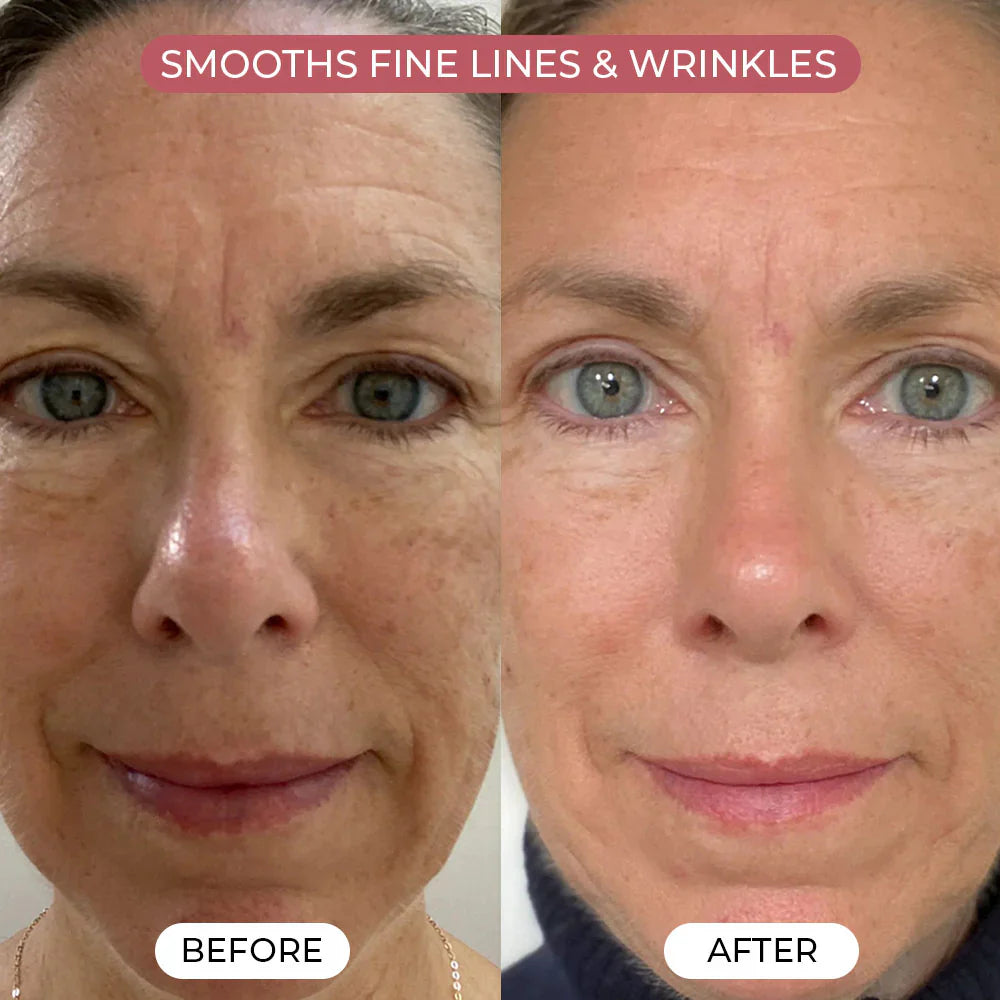 Enliwish PDRN Pink Collagen Mask