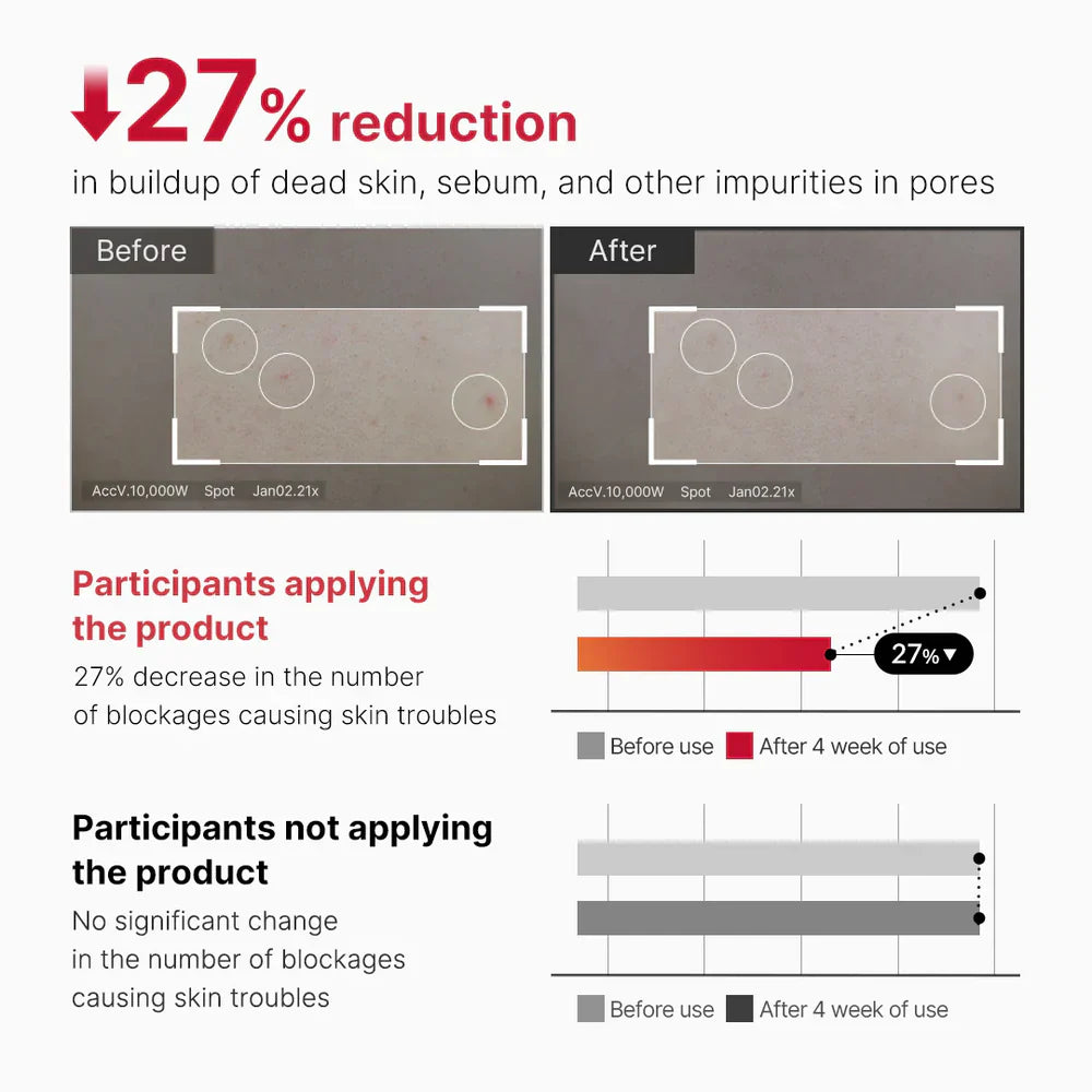 Medicube Red Body Peeling Shot, AHA + BHA Exfoliating Body Spray