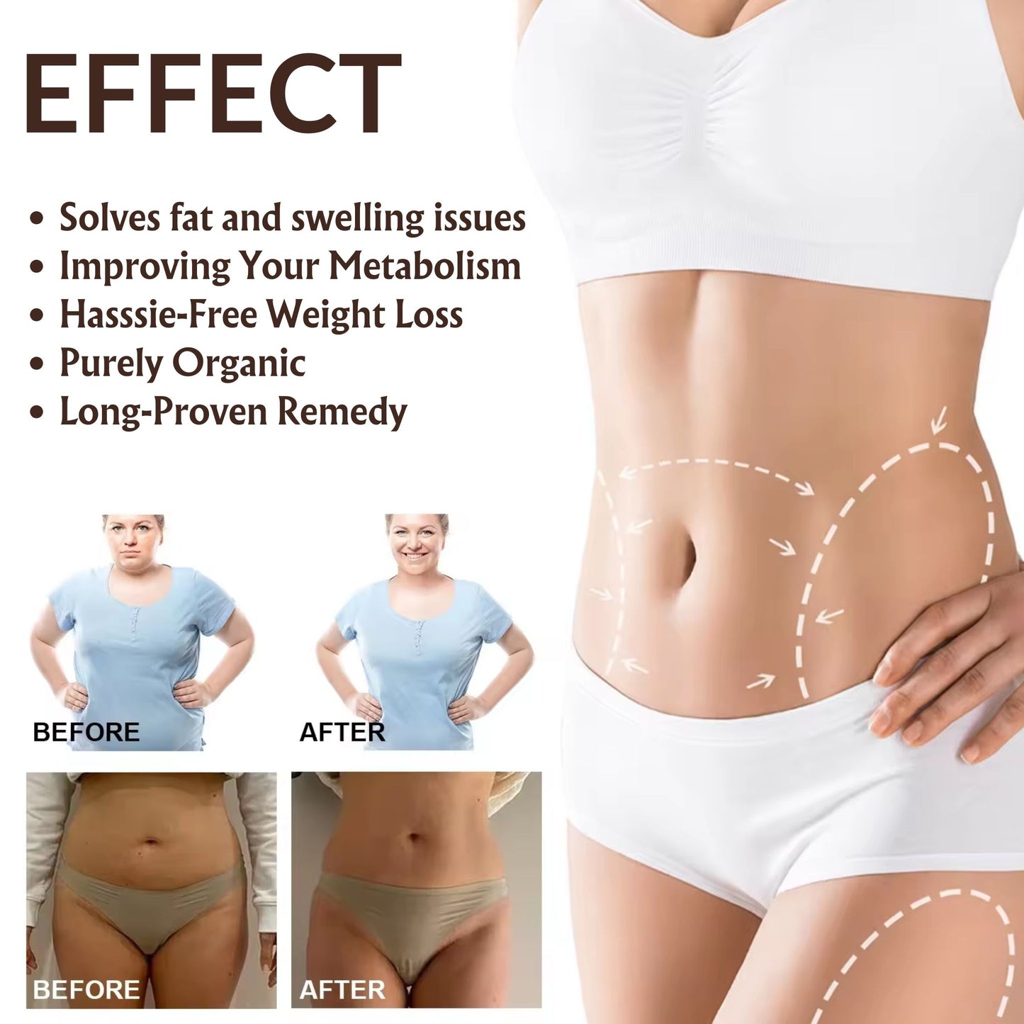 Enliwish Silicone Anti Stretch Mark Stomach Patches