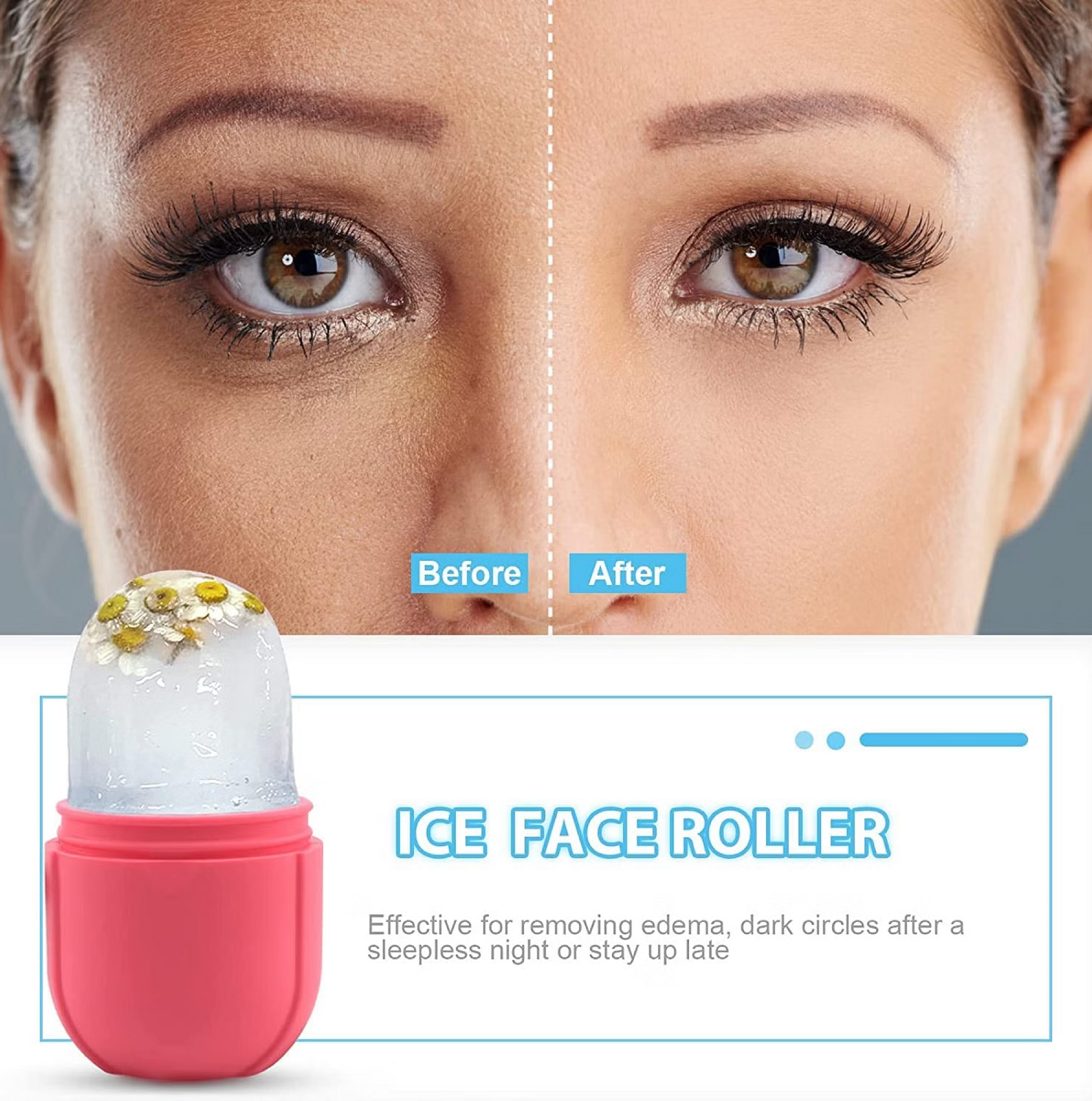 Ice Face Roller for Puffiness & Acne Control